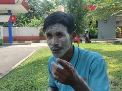 Korban Cerita Detik-detik Api Muncul di SPBU Soekarno-Hatta Lebak