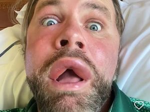 Bibir Digigit Lebah, Brian McFadden Eks Westlife Ngaku Jadi Keren Begini