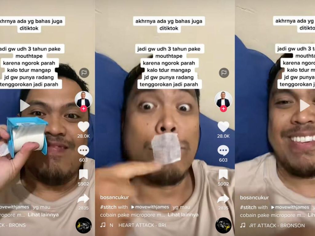Viral Pria Mouthtaping Plester di Mulut buat Stop Ngorok, Aman atau Bahaya? Viral Pria Mouthtaping Plester di Mulut buat Stop Ngorok, Aman atau Bahaya?