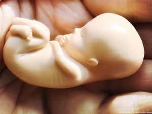 Kelompok HAM Filipina Khawatirkan Kemunduran Hak Aborsi Seperti AS