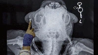 Deretan Foto X-Ray yang Bikin Merinding