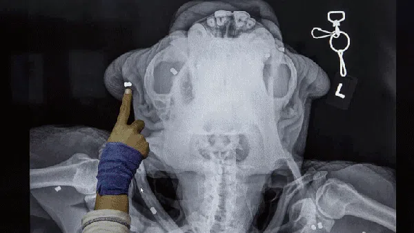 Deretan Foto X-Ray yang Bikin Merinding