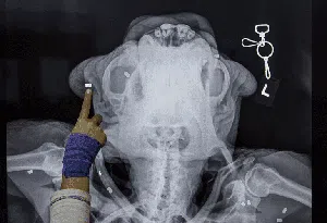 Deretan Foto X-Ray yang Bikin Merinding Deretan Foto X-Ray yang Bikin Merinding