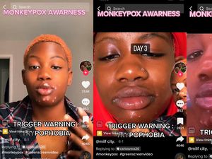 Curhat Wanita Kena Cacar Monyet, Ngaku Tertular dari Uang Kotor di SPBU