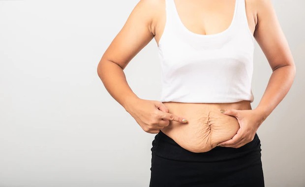 stigma terkait berat badan pada perempuan pascamelahirkan