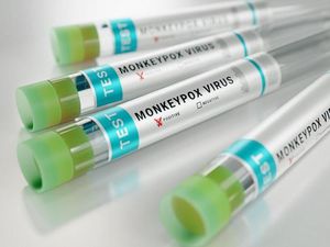Sudah Ada 17 Kasus Mpox di Indonesia, Positivity Rate PCR Tembus 44 Persen! Sudah Ada 17 Kasus Mpox di Indonesia, Positivity Rate PCR Tembus 44 Persen!