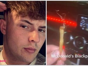 Duh! Pria Ini Temukan Kaki Mencurigakan Dalam Kentang Gorengnya