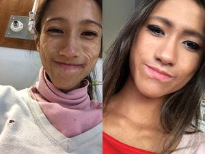 Viral Curhat Dokter Hampir Tewas Gegara Terlalu Kurus, Bobotnya Cuma 30 Kg