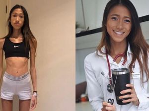 Terobsesi Kurus, Dokter Ini Sempat Punya BB 30 Kg Sampai Hampir Meninggal Terobsesi Kurus, Dokter Ini Sempat Punya BB 30 Kg Sampai Hampir Meninggal