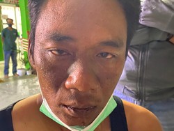 Tampang Pembunuh Pasutri di Baubau Usai Ditangkap-Ditembaki Polisi