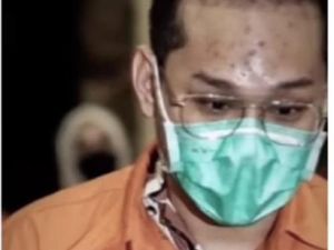 Indra Kenz Jerawatan Selama di Penjara Curi Perhatian Netter