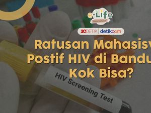 Heboh Ratusan Mahasiswa Bandung Kena HIV, Dari Mana Sih Awal Mulanya? Heboh Ratusan Mahasiswa Bandung Kena HIV, Dari Mana Sih Awal Mulanya?