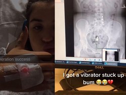 Horor! Viral Wanita Curhat Mainan Seks Nyangkut di Pantat Sampai Harus Operasi