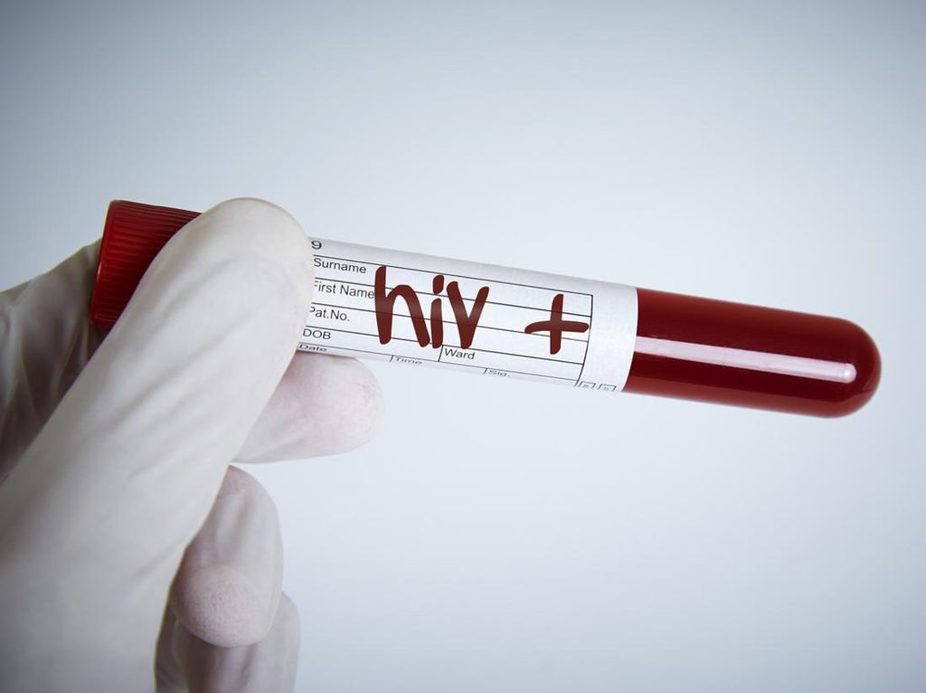 Sepanjang 2022, 6 Anak di Sukabumi Meninggal Akibat HIV/AIDS Sepanjang 2022, 6 Anak di Sukabumi Meninggal Akibat HIV/AIDS