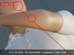 4 Bagian Tubuh Brigadir J yang Kena Tembakan Bharada E