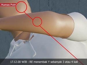 4 Bagian Tubuh Brigadir J yang Kena Tembakan Bharada E 4 Bagian Tubuh Brigadir J yang Kena Tembakan Bharada E