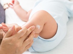 Dokter Tegaskan Kulit Bayi Bersisik karena Bumil Doyan Minum Es Cuma Mitos