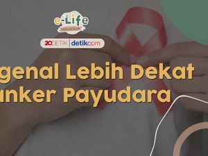 Penyebab Kanker Payudara dan Siapa yang Paling Berisiko
