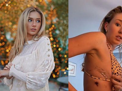 7 Foto Wanita Cantik yang Paru-parunya Bocor Gegara Ngevape