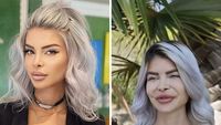 Foto Perbedaan Jauh Instagram Vs Realita, Asli Bikin Kaget!