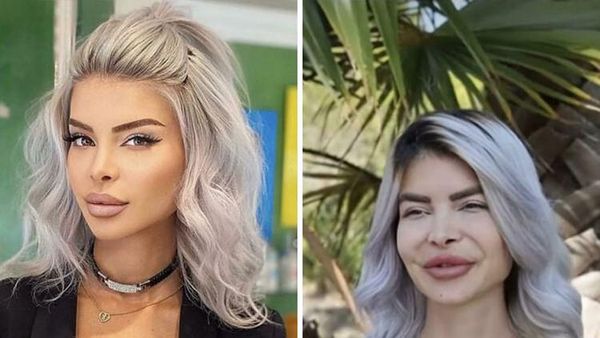 Foto Perbedaan Jauh Instagram Vs Realita, Asli Bikin Kaget!