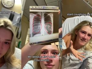 Viral Wanita 23 Tahun Curhat Hampir Mati Gegara Vape: Paru Rusak-Batuk Darah Viral Wanita 23 Tahun Curhat Hampir Mati Gegara Vape: Paru Rusak-Batuk Darah