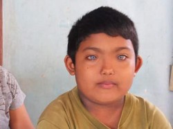 Bocah Bermata Biru dari Buleleng Pernah Dirundung Saat TK