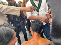 Mahasiswa di Malang Terbakar saat Demo Tolak Harga BBM Naik