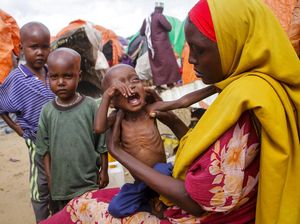 Wajah Anak-anak Somalia yang Kena Gizi Buruk, Beneran Menyedihkan Wajah Anak-anak Somalia yang Kena Gizi Buruk, Beneran Menyedihkan
