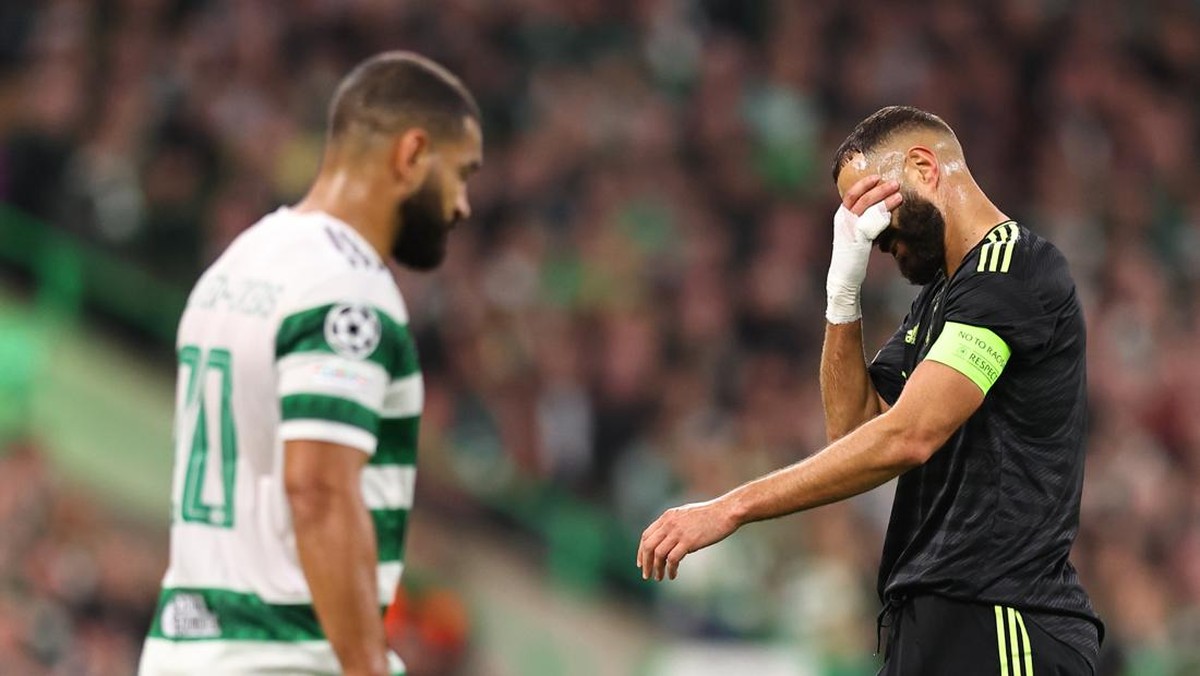 Real Madrid kewalahan hadapi Celtic di babak pertama. (Foto: Getty Images/Robbie Jay Barratt - AMA)