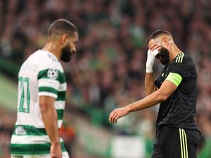 Babak I Celtic Vs Madrid: Los Blancos Kewalahan, Benzema Cedera