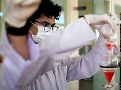 Alumni SMK-SMAK Bogor Tembus Banyak PTN, Ada yang Masuk Kedokteran Gigi