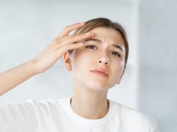 8 Tanda Kulit Berminyak yang Mudah Jerawatan dan Makeup Gampang Luntur