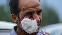 Seisi Khasmir India Heboh Gegara Serangan Beruang Liar