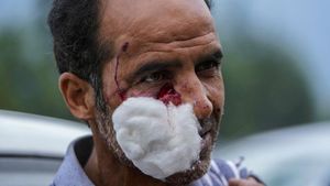 Seisi Khasmir India Heboh Gegara Serangan Beruang Liar
