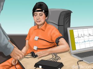 Janggal Kekerasan Seksual Istri Sambo