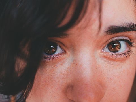 Kulit kemerahan akibat iritasi.