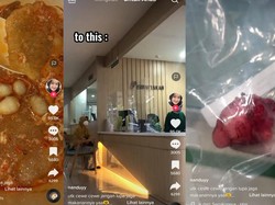 Fakta-fakta Wanita di Palembang Kena Tumor Payudara, Gegara Seblak?