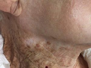 Viral Penampakan Wajah Vs Leher yang Pakai Sunscreen dan Tidak