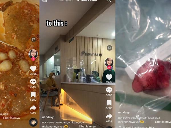6 Foto Wanita Idap Tumor Payudara, Ngaku Gegara Sering Nyeblak