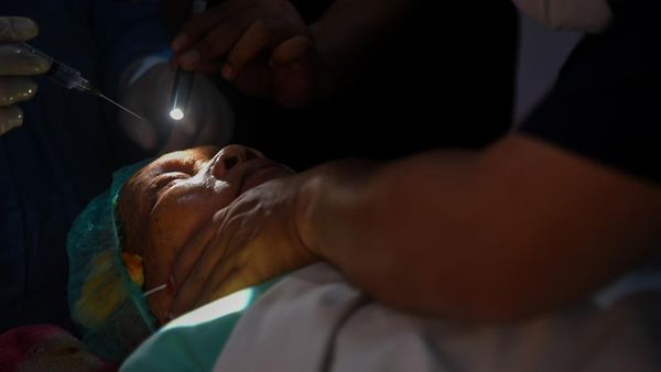 Operasi Katarak Gratis di RS Bhayangkara Sumut