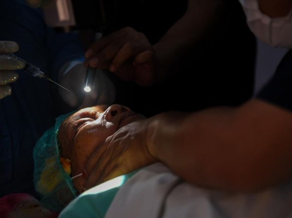 Operasi Katarak Gratis di RS Bhayangkara Sumut