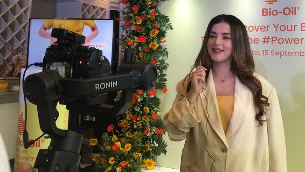 Rahasia Tasya Farasya Tetap Bening Meski Mager Skincare-an saat Hamil
