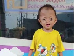 Mari Bantu Rasyid, Anak Buruh Cuci Penderita Sindrom Apart Sindaktili