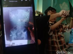 Jabar Hari Ini: Geger Bocah Telan Kunci hingga Kecelakaan Maut di Cipali Jabar Hari Ini: Geger Bocah Telan Kunci hingga Kecelakaan Maut di Cipali