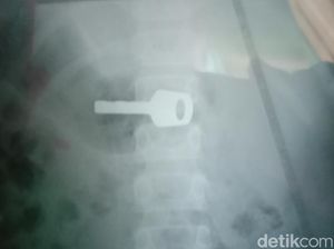 Zul Merintih Kesakitan Saat Kunci Gembok Masuk ke Perutnya Zul Merintih Kesakitan Saat Kunci Gembok Masuk ke Perutnya
