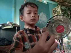 Biaya Perawatan Bocah Telan Kunci Gembok Ditanggung Pemerintah