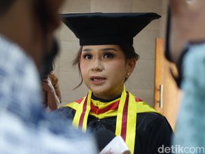 UGM Luluskan Doktor Baru, Teliti Metode Deteksi Glaukoma Lebih Dini UGM Luluskan Doktor Baru, Teliti Metode Deteksi Glaukoma Lebih Dini