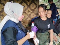 Kemenkes Pantau Warga Baduy yang Diduga Terjangkit TBC dan Campak