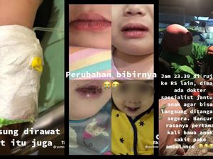 Dirut BPJS Pastikan Pengobatan Penyakit Kawasaki Ditanggung BPJS Dirut BPJS Pastikan Pengobatan Penyakit Kawasaki Ditanggung BPJS